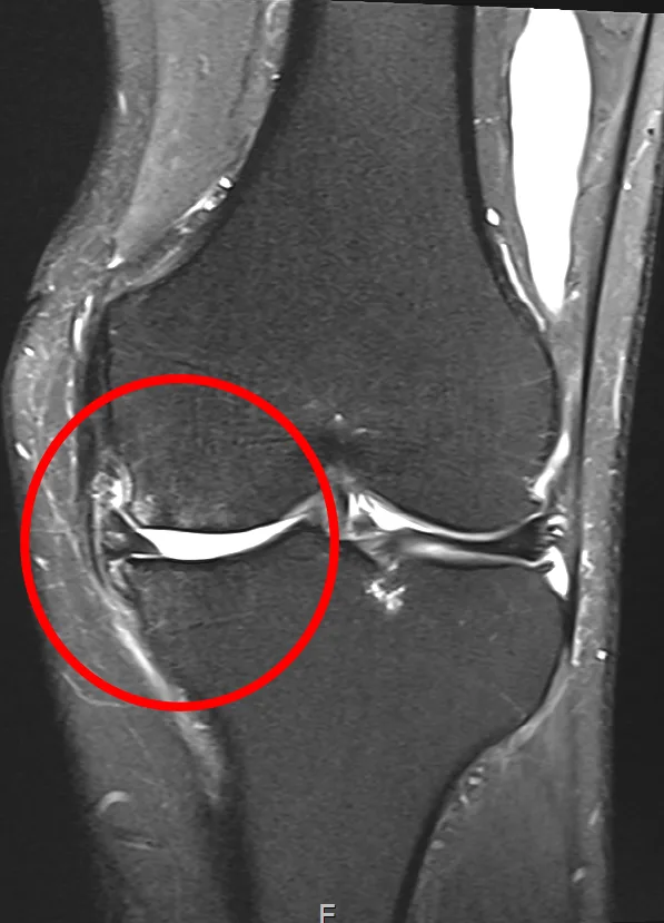 큰힘병원 무릎·인공관절 수술 전 MRI